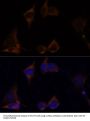 Interleukin 13 Receptor Alpha 2 (IL13RA2) Antibody