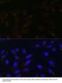 Interleukin 13 Receptor Alpha 2 (IL13RA2) Antibody