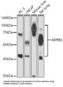 Beta-2 Adrenergic Receptor (ADRB2) Antibody