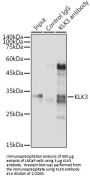 Prostate-Specific Antigen / PSA (KLK3) Antibody