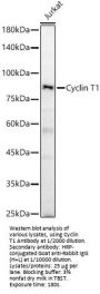 Cyclin-T1 (CCNT1) Antibody