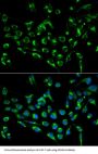 Cyclin Dependent Kinase Inhibitor 3 (CDKN3) Antibody