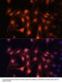 E2F Transcription Factor 1 (E2F1) Antibody