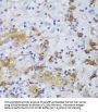 Glycogen Synthase Kinase 3 Beta (GSK3B) Antibody