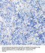 Glycogen Synthase Kinase 3 Beta (GSK3B) Antibody
