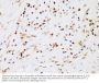 Inhibitor of Nuclear Factor Kappa-B Kinase Subunit Beta / IKKB (IKBKB) Antibody