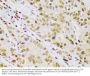 Inhibitor of Nuclear Factor Kappa-B Kinase Subunit Beta / IKKB (IKBKB) Antibody