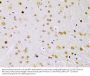 Inhibitor of Nuclear Factor Kappa-B Kinase Subunit Beta / IKKB (IKBKB) Antibody