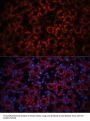Neutrophil Gelatinase Associated Lipocalin / NGAL (LCN2) Antibody