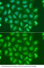 DNA-Directed RNA Polymerase II Subunit RPB1 (POLR2A) Antibody