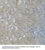 Protein Tyrosine Kinase 2 Beta (PTK2) Antibody