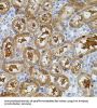 Protein Tyrosine Kinase 2 Beta (PTK2) Antibody