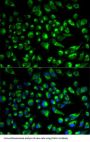 Hyaluronidase PH-20 (SPAM1) Antibody