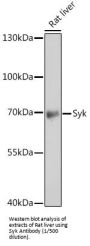 Spleen Associated Tyrosine Kinase (SYK) Antibody