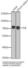 Spleen Associated Tyrosine Kinase (SYK) Antibody