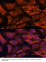 Mucosa-Associated Lymphoid Tissue Lymphoma Translocation Protein 1 (MALT1) Antibody