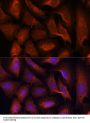 Mucosa-Associated Lymphoid Tissue Lymphoma Translocation Protein 1 (MALT1) Antibody