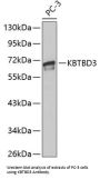 Kelch Repeat And BTB Domain-Containing Protein 3 (KBTBD3) Antibody
