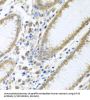Eukaryotic Translation Initiation Factor 4E (EIF4E) Antibody
