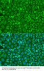 Eukaryotic Translation Initiation Factor 4E (EIF4E) Antibody