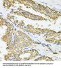 HLA Class II Histocompatibility Antigen, DQ Alpha 1 Chain (HLA-DQA1) Antibody