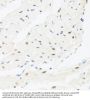 Interferon Regulatory Factor 3 (IRF3) Antibody