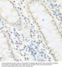 Interferon Regulatory Factor 3 (IRF3) Antibody