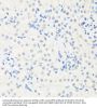 Interferon Regulatory Factor 3 (IRF3) Antibody