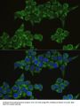 Interferon Regulatory Factor 3 (IRF3) Antibody