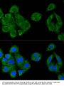 Interferon Regulatory Factor 3 (IRF3) Antibody