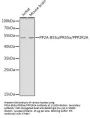 Protein Phosphatase 2 Regulatory Subunit Balpha (PPP2R2A) Antibody