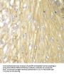 Protein Phosphatase 2 Regulatory Subunit Balpha (PPP2R2A) Antibody