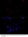 TATA Box Binding Protein (TBP) Antibody