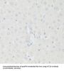 Histone Acetyltransferase KAT2A (KAT2A) Antibody