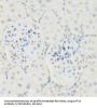 Histone Acetyltransferase KAT2A (KAT2A) Antibody