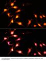 Histone Acetyltransferase KAT2A (KAT2A) Antibody