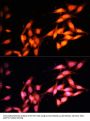 Histone Acetyltransferase KAT2A (KAT2A) Antibody