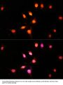 Histone Acetyltransferase KAT2A (KAT2A) Antibody