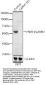 Coactivator-Associated Arginine Methyltransferase 1 (CARM1) Antibody