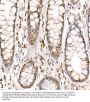 Coactivator-Associated Arginine Methyltransferase 1 (CARM1) Antibody