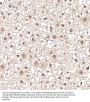 Coactivator-Associated Arginine Methyltransferase 1 (CARM1) Antibody