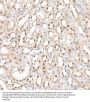 Coactivator-Associated Arginine Methyltransferase 1 (CARM1) Antibody