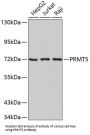 Protein Arginine N-Methyltransferase 5 (PRMT5) Antibody