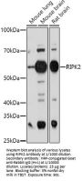 Receptor Interacting Serine Threonine Kinase 2 (RIPK2) Antibody