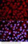 Calcium/Calmodulin Dependent Serine Protein Kinase (CASK) Antibody