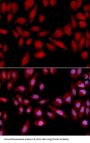 Proteasome Subunit Alpha Type 2 (PSMA2) Antibody