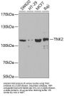 Tyrosine Kinase, Non Receptor 2 / ACK1 (TNK2) Antibody