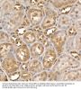 Tyrosine Kinase, Non Receptor 2 / ACK1 (TNK2) Antibody