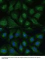 Dickkopf-Related Protein 3 (DKK3) Antibody