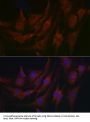 Bone Marrow Proteoglycan (PRG2) Antibody